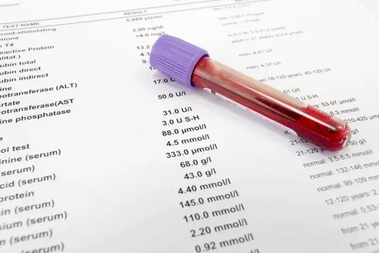 Jak interpretować wyniki badań laboratoryjnych?