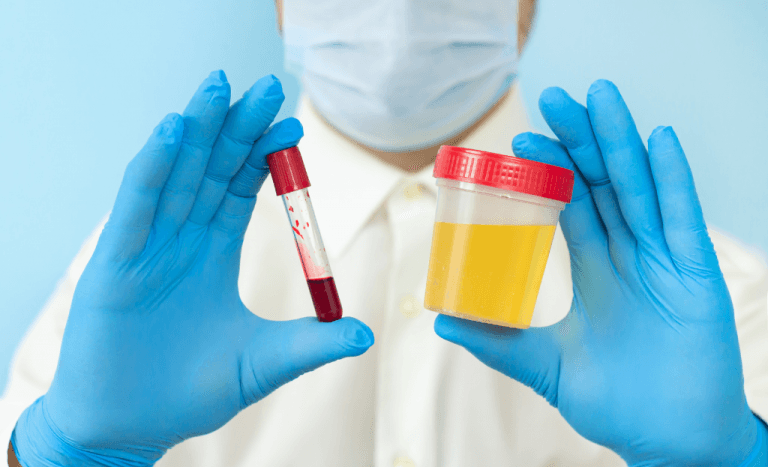 Erytrocyty w moczu – co oznaczają? Jak leczyć? - okładka