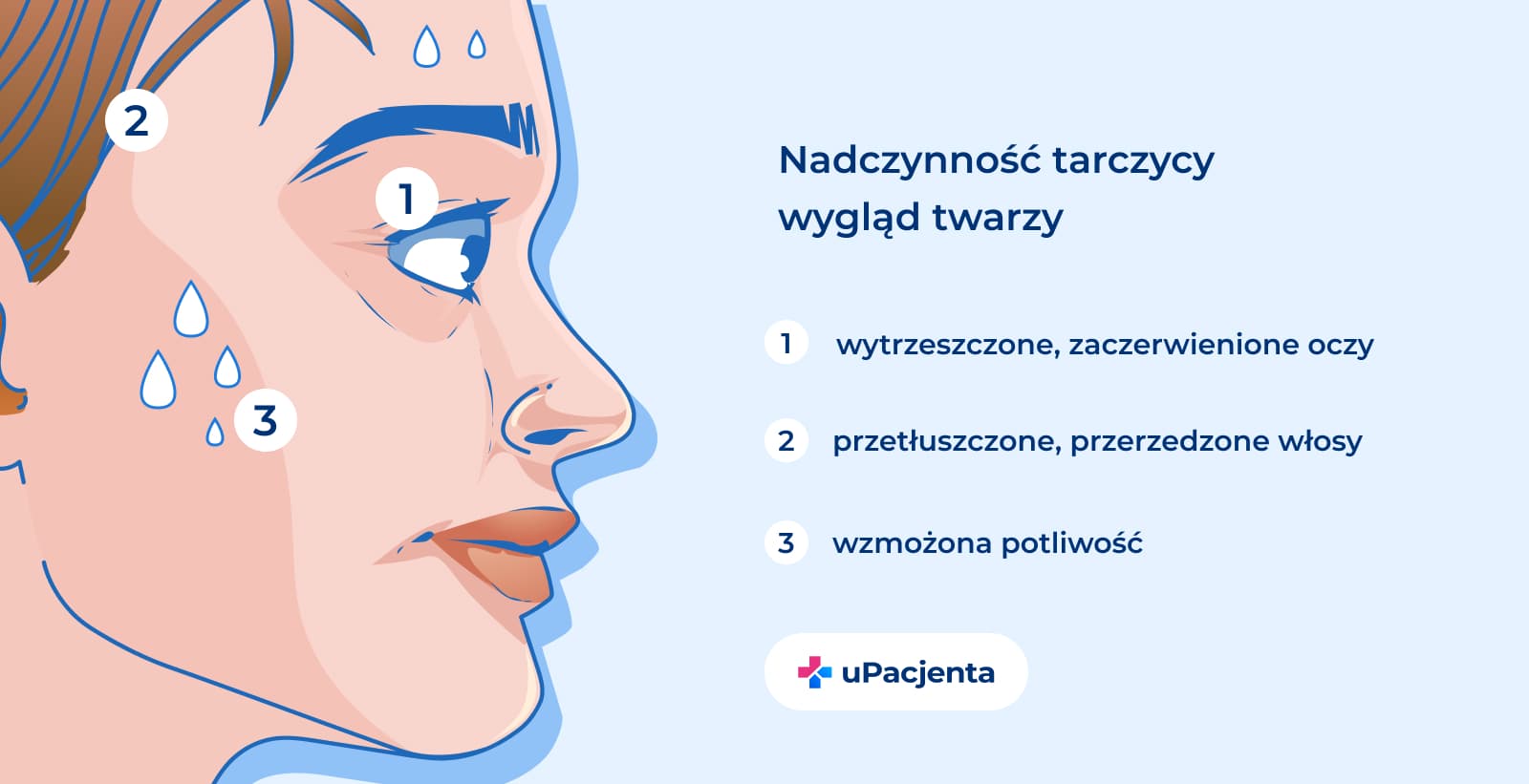 nadczynność tarczycy wygląd twarzy