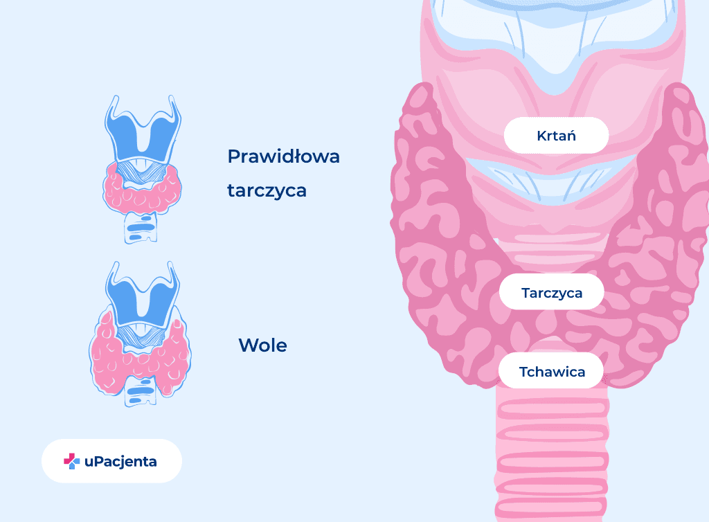 Wole tarczycy zdjęcia