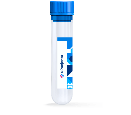 Kiła (Treponema pallidum), test przesiewowy RPR/VDRL