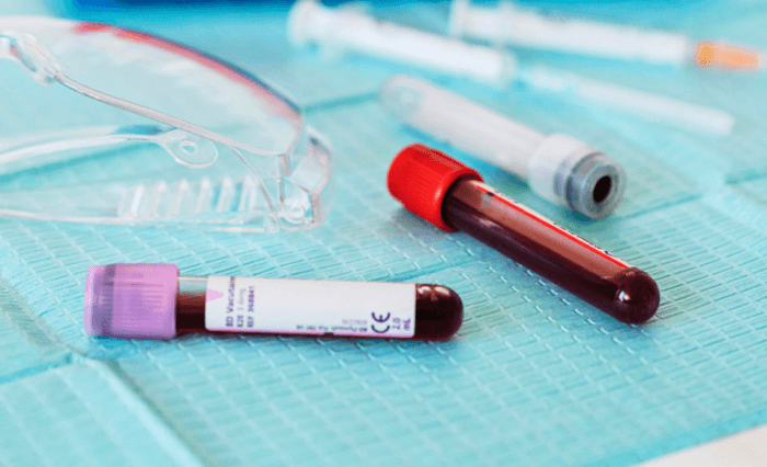 Podwyższone leukocyty we krwi – przyczyny, leczenie