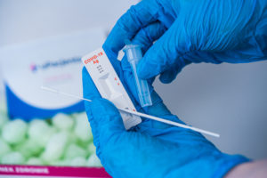 Test antygenowy Covid-19 (SARS-CoV-2)